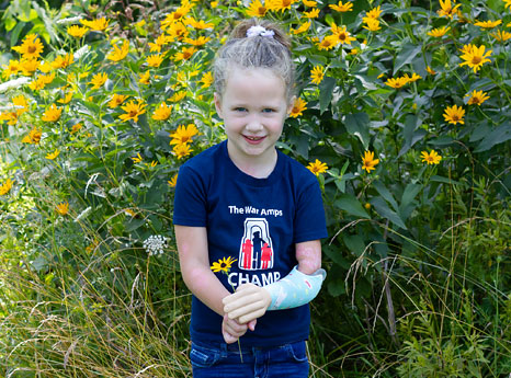 A young female arm amputee smiles and stands in front of a field of flowers.