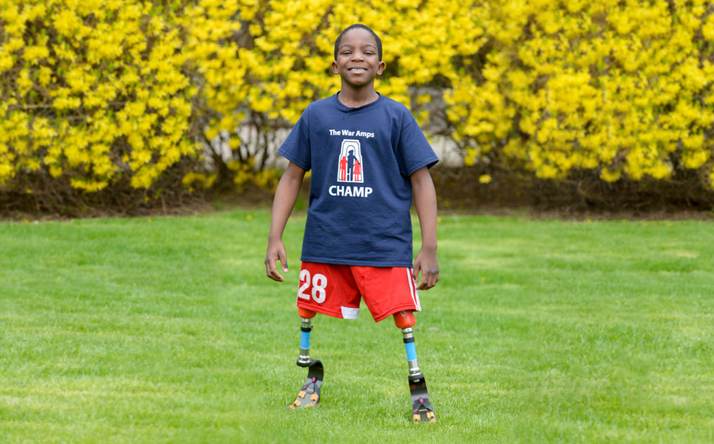 Feranmi, a double leg amputee, stands in a field while wearing his running legs.