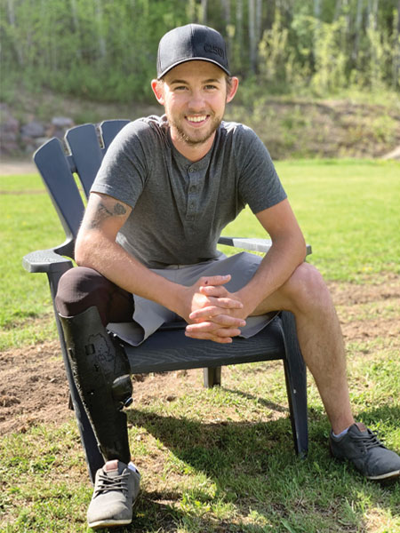 A male young adult leg amputee sits on a Muskoka chair outside while wearing his artificial leg.
