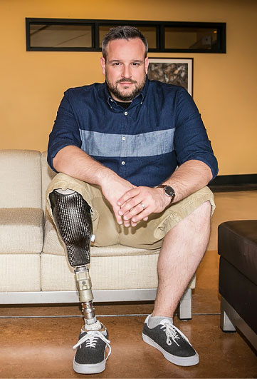 An adult male leg amputee sits on a couch.