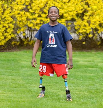 A young male double-leg amputee stands in a field while wearing his running legs.