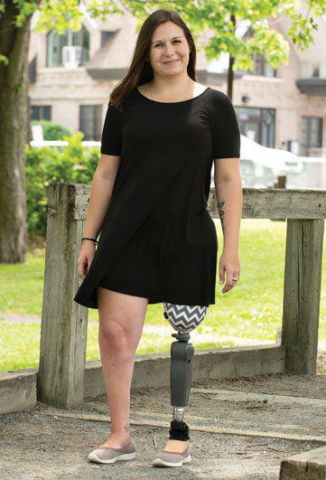 A female adult leg amputee walks in a grassy park.