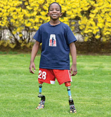 Un jeune garçon amputé des deux jambes se tient debout sur une pelouse avec ses jambes de course.