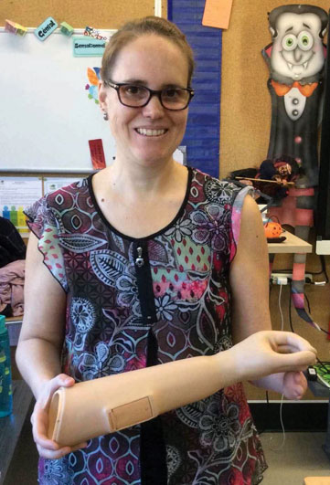 An adult female arm amputee holds an artificial limb in a classroom.