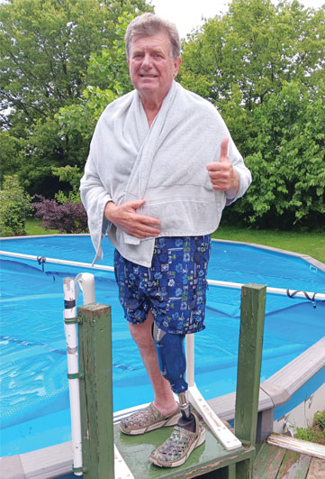 An older adult male leg amputee stands beside a backyard pool.