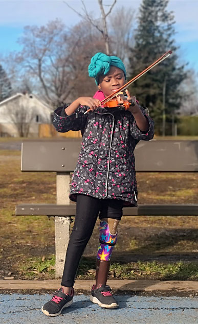 A young female multiple amputee stands in a park and plays the violin.
