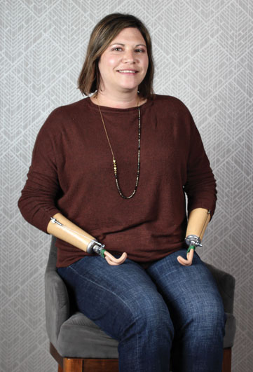 An adult female double arm amputee sits on a chair inside.