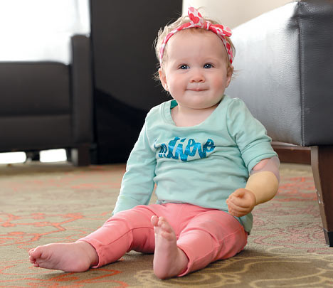 A baby girl wearing a prosthetic arm sitting on the floor smiling.