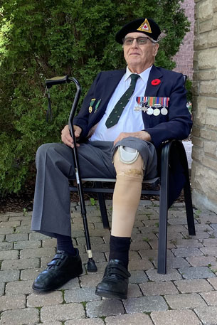 L’ancien combattant de la Seconde Guerre mondiale, Charlie Jefferson a été blessé par l’explosion d’une mine antipersonnel, résultant en l’amputation de sa jambe gauche au-dessous du genou.