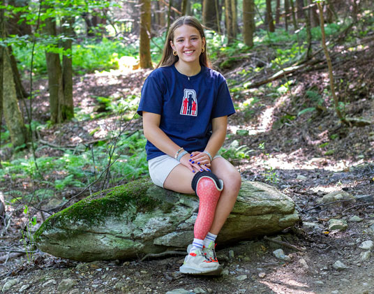 Florence, qui est amputée d’une jambe, est assise sur une roche dans une forêt.