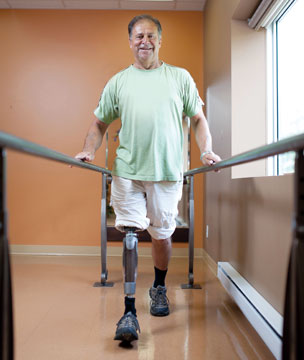 A male amputee wearing a prosthetic leg and walking using parallel bars.