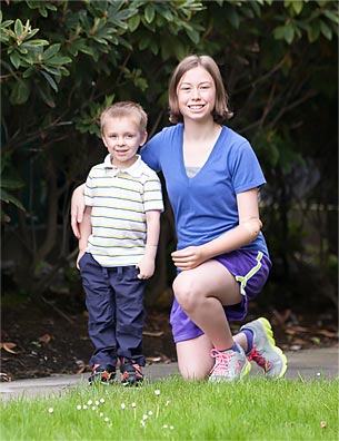 A girl and boy who are both arm amputees together in a park.