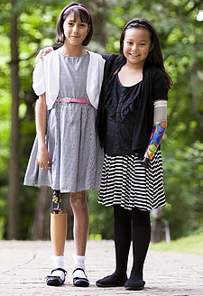 Two young girls who are both amputees standing together in a park.