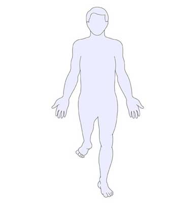 An anatomy-style illustration of a man's body showing a Rotationplasty (Van Nes Rotation).